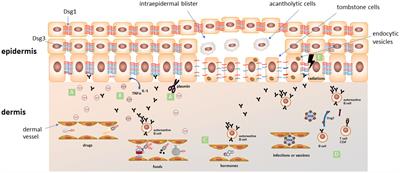 Pemphigus: trigger and predisposing factors